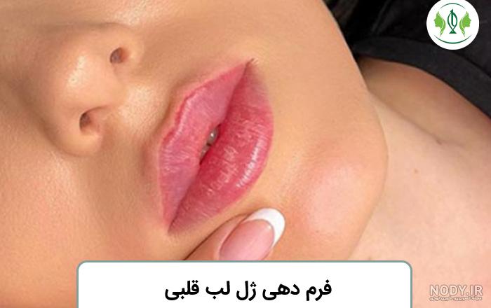 همه چیز درباره تزریق ژل لب مدل عروسکی یا باربی - مطب خانم دکتر مریم ضابطی - مادر لیپوماتیک ایران همه چیز درباره تزریق ژل لب مدل عروسکی یا باربی - مطب خانم دکتر مریم ضابطی - مادر لیپوماتیک ایران