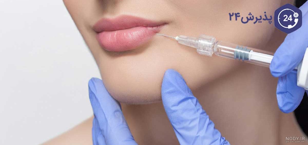 پروتز لب روسی چیست؟ انواع، روش انجام، عوارض + عکس آن پروتز لب روسی چیست؟ انواع، روش انجام، عوارض + عکس آن