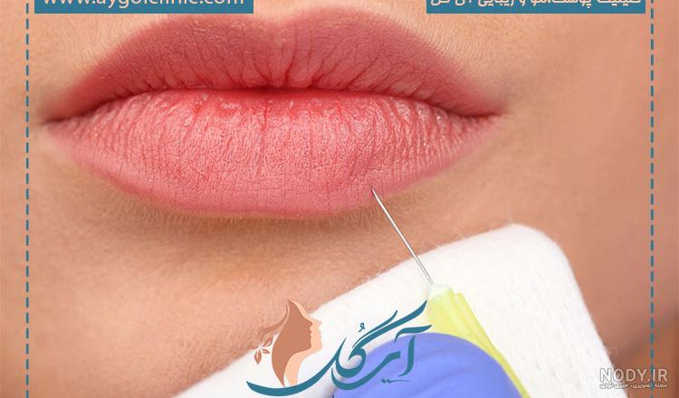 پک رژلب جامد طرح قلب مک MAC | پیراکده
