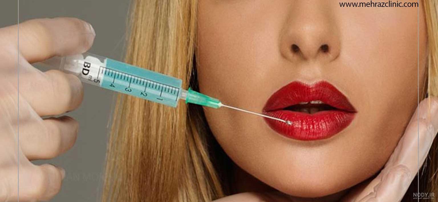 ژل لب و 10 تا از مهمترین مزایا و معایب آن|دکتر محمدرضا شجاعی ژل لب و 10 تا از مهمترین مزایا و معایب آن|دکتر محمدرضا شجاعی