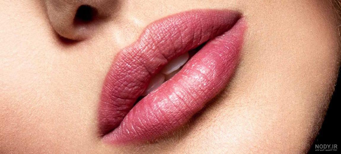 ژل لب روسی: نحوه تزریق، عکس ژل روسی، قیمت و عوارض – مجله سلامت دکترتو ژل لب روسی: نحوه تزریق، عکس ژل روسی، قیمت و عوارض – مجله سلامت دکترتو