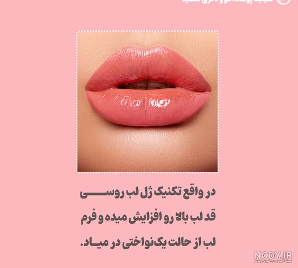 ژل لب روسی چیست و چگونه تزریق آن انجام می شود | نمونه کار تزریق ژل لب روسی | تزریق ژل در کرج ژل لب روسی چیست و چگونه تزریق آن انجام می شود | نمونه کار تزریق ژل لب روسی | تزریق ژل در کرج