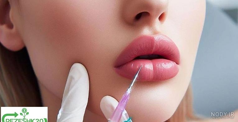 ژل لب مدل قلبی: تکنیک تزریق ژل لب مدل قلبی تجربه تزریق مدل لب قلبی نی نی  سایت