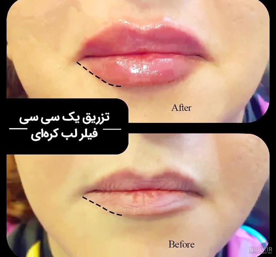 ژل لب مدل کره ای، هر آنچه باید بدانید! ژل لب مدل کره ای، هر آنچه باید بدانید!