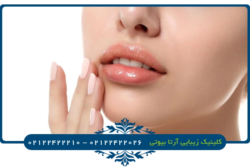 ژل لب کره ای رووفیل ✓ + فیلم و عکس ✔️ | مرکز زیبایی و لیزر ژل لب کره ای رووفیل ✓ + فیلم و عکس ✔️ | مرکز زیبایی و لیزر