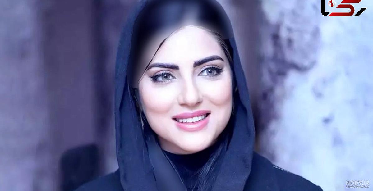تغییر چهر هلیا دختر قمه کش اصفهانی پس از عمل جراحی بینی / فیلم تغییر چهر هلیا دختر قمه کش اصفهانی پس از عمل جراحی بینی / فیلم