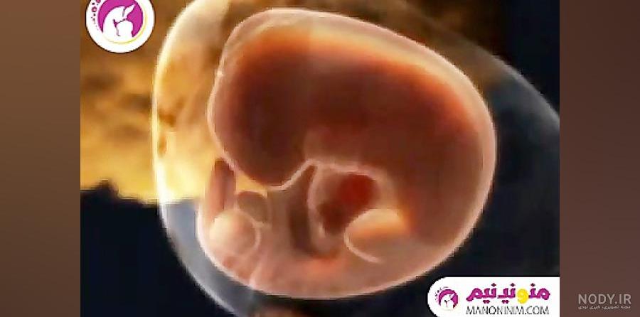 دلایل اصلی سقط جنین دلایل اصلی سقط جنین