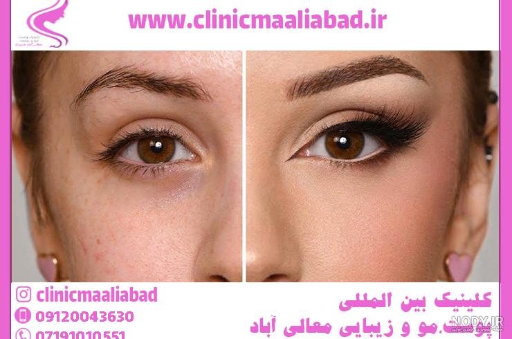 راز چشمان گربه ای خانم بازیگر فاش شد!/عکس