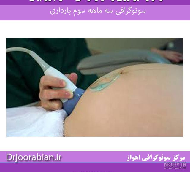 رشد جنین یک ماهه، آنچه میخواهید بدانید رشد جنین یک ماهه، آنچه میخواهید بدانید