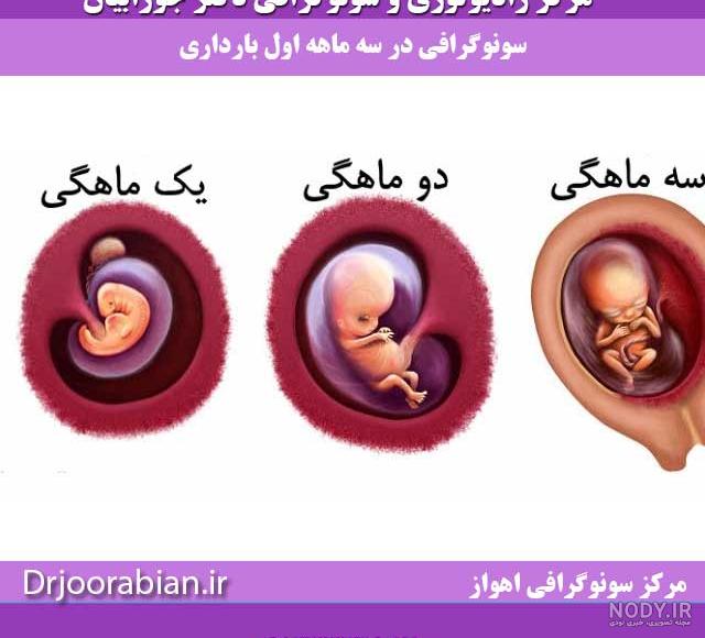 عکس جنین سقط شده در ماه سوم عکس جنین سقط شده در ماه سوم