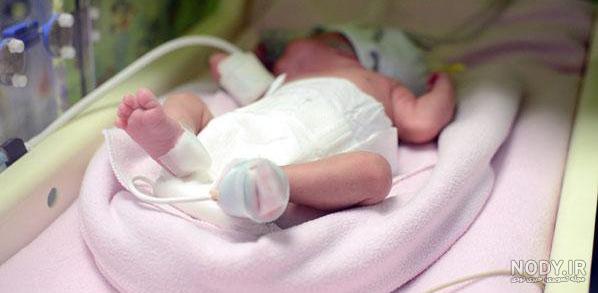 عکس جنین سه ماه و نیم عکس جنین سه ماه و نیم