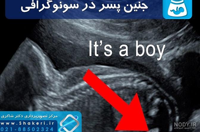 عکس جنین سه ماه پسر عکس جنین سه ماه پسر