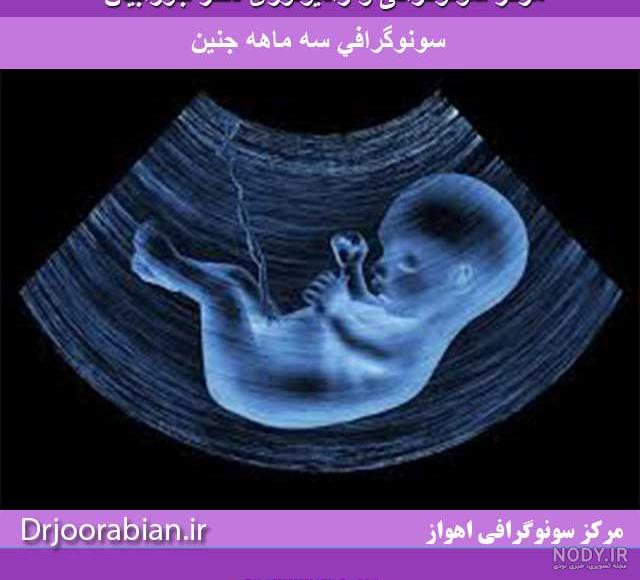 عکس سه ماه جنین عکس سه ماه جنین