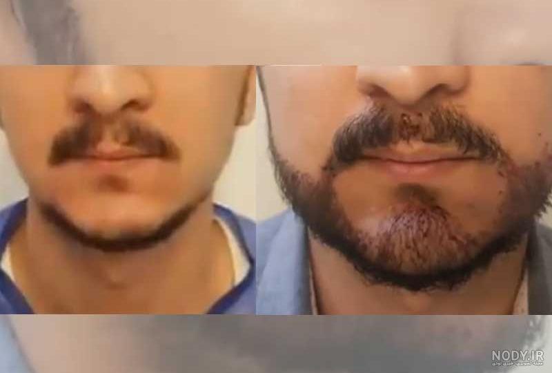 عکس مرد پر سیبیل - عکس نودی