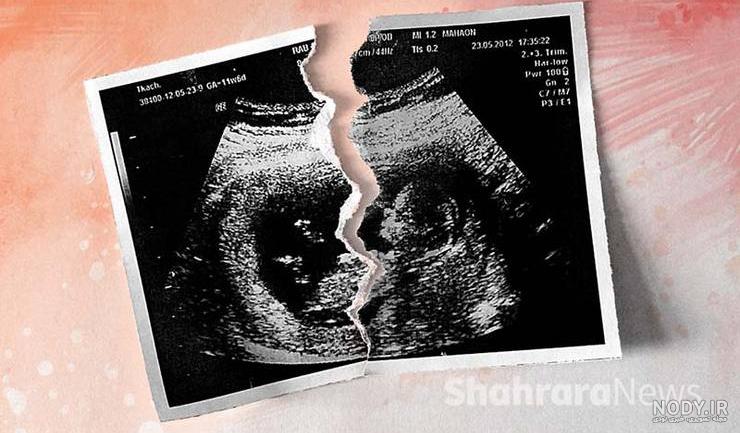 عکس نوشته غمگین سقط جنین - عکس نودی