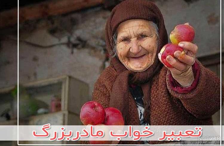 عکس های واقعی دختری با صورت زشت و قلبی زیبا +عکس
