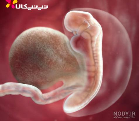 نوزاد نارس پنج ماهه زنجاني پس از دو ماه مراقبت هاي ويژه راهي خانه شد - ایرنا نوزاد نارس پنج ماهه زنجاني پس از دو ماه مراقبت هاي ويژه راهي خانه شد - ایرنا