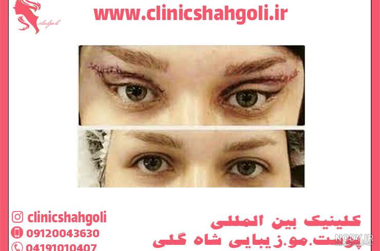 گربه ای با چشمان درشت