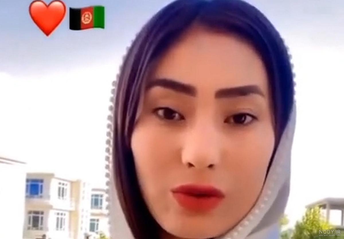 مشرق نیوز - عکس/ انفجار مرگبار مقابل دبیرستان دخترانه در ‎کابل