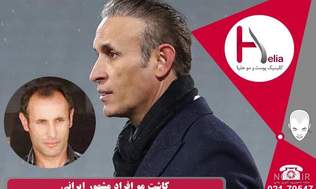 احسان علیخانی بعد شکست عشقی کچل شد! | عکس جدید احسان علیخانی مردم ایران را متعجب کرد! احسان علیخانی بعد شکست عشقی کچل شد! | عکس جدید احسان علیخانی مردم ایران را متعجب کرد!