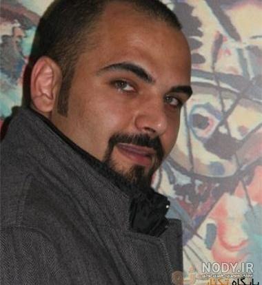 مو کاشتن احسان علیخانی افشا شد + عکس کچلی احسان علیخانی مو کاشتن احسان علیخانی افشا شد + عکس کچلی احسان علیخانی