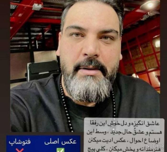 کاشت مو در افراد مشهور | احسان علیخانی، یحیی گل محمدی (سلبریتی ایرانی و خارجی) - کلینیک هلیا کاشت مو در افراد مشهور | احسان علیخانی، یحیی گل محمدی (سلبریتی ایرانی و خارجی) - کلینیک هلیا