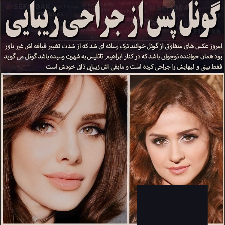 اهنگ neyin sesiyem از گونل gunel | طرفداری