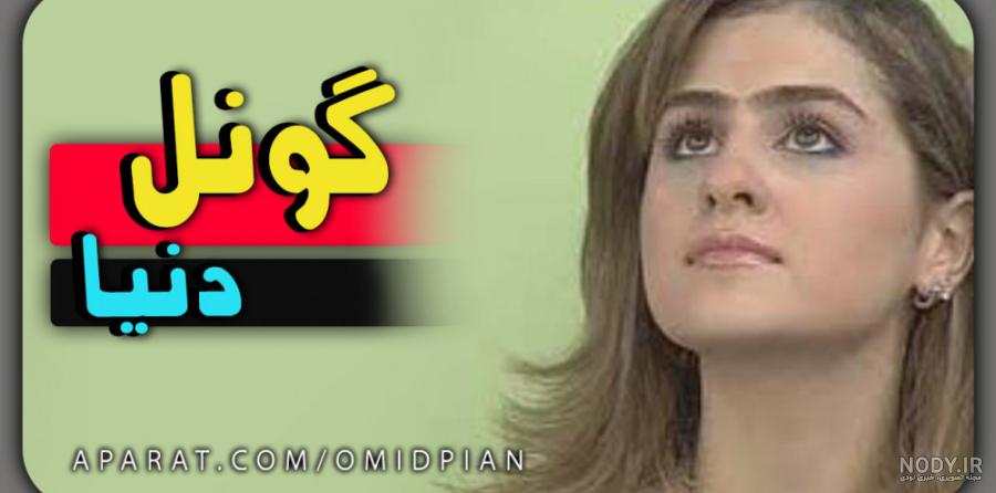 تغییر چهره شدید گونل خواننده معروف ترک بعد از عمل زیبایی!