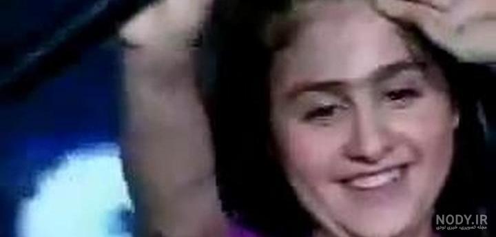 عمل زیبایی گونل که ملکه زیبایی ترکیه شد ! / چی بود و چی شد ؟! + عکس ها از  نوجوانی تا الان