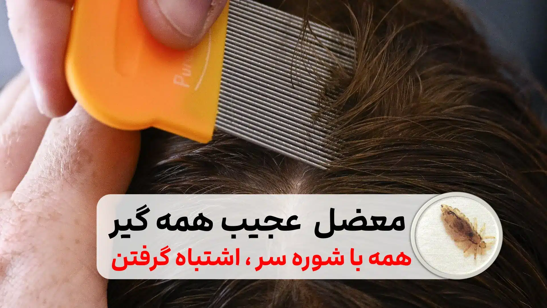 انواع شپش | درمان شپش سر