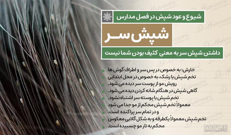 تشخیص تخم شپش و روش های درمان آن :: شامپوی شپش