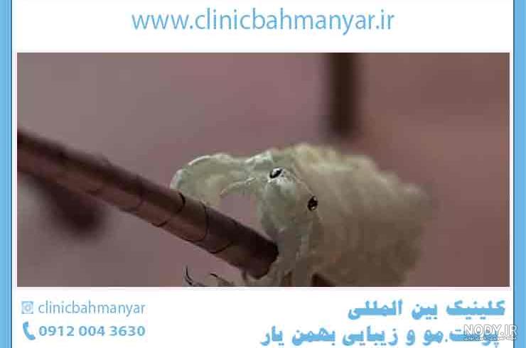 تصویر جالب «شپش» زیر میکروسکوپ !