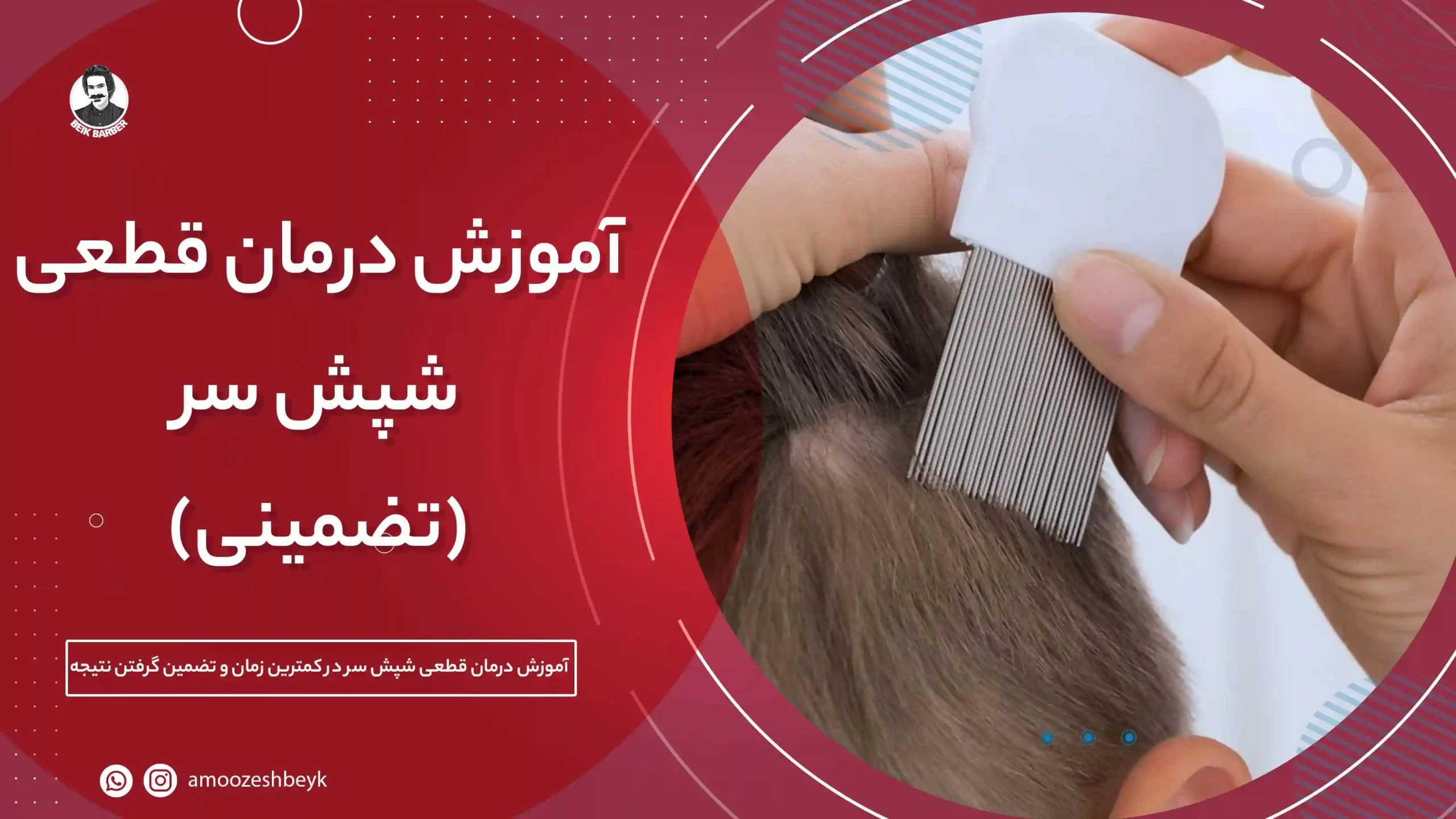 سزامول | بهترین درمان شپش سر در کودکان و نوجوانان سزامول | بهترین درمان شپش سر در کودکان و نوجوانان