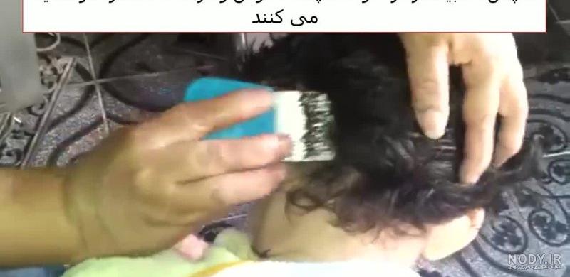 شپش سر را در 3 سوت درمان کنید !! ( با عکس ) – کوروک شپش سر را در 3 سوت درمان کنید !! ( با عکس ) – کوروک