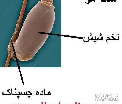 شپش سر چیست و تشخیص آن چگونه است؟ شپش سر چیست و تشخیص آن چگونه است؟