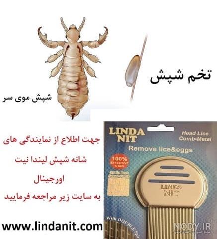 شپش چیست؟ ⚡️ علائم و عکس شپس سر، 3 روش درمان خانگی