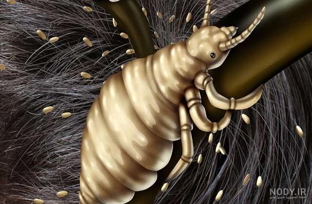 طول عمر شپش سر | روغن های آرایشی و زیبایی قانون