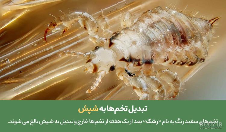 عکس تخم شپش روی مو عکس تخم شپش روی مو