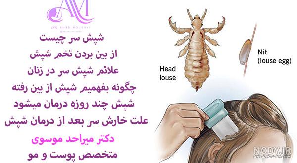 عکس تخم شپش روی موی سر عکس تخم شپش روی موی سر