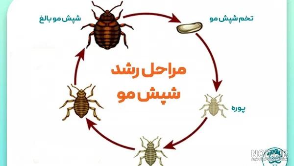 عکس تخم شپش سر کودک عکس تخم شپش سر کودک