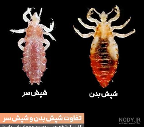 عکس تخم شپش پوچ عکس تخم شپش پوچ