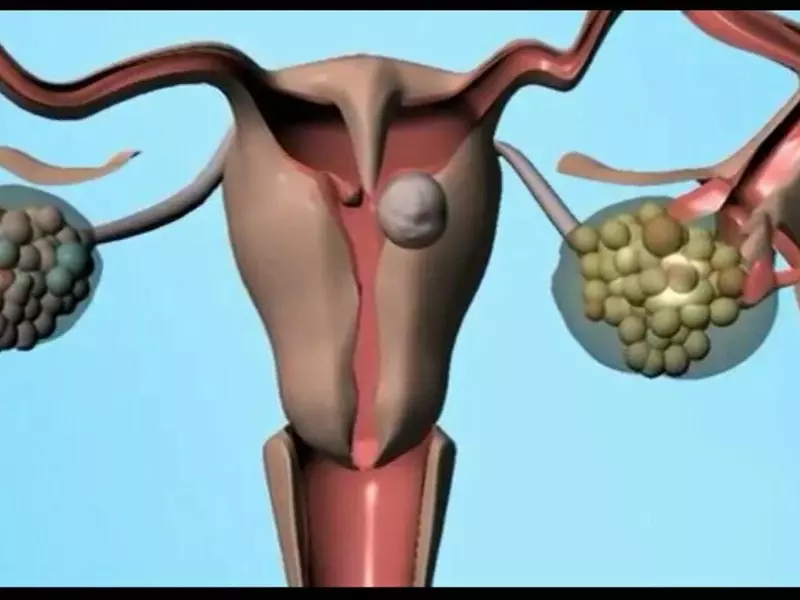 عکس رنگی کن - عکس نودی