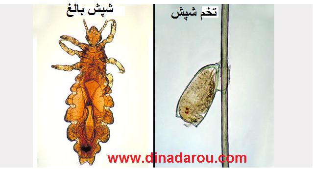 عکس شپش بدن عکس شپش بدن