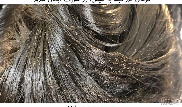 عکس شپش تخم گذار عکس شپش تخم گذار