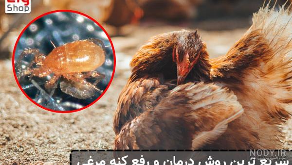 عکس شپش سر بزرگ - عکس نودی