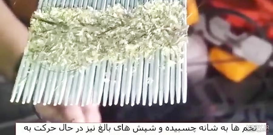 عکس شپش مو به همراه عکس تخم شپش