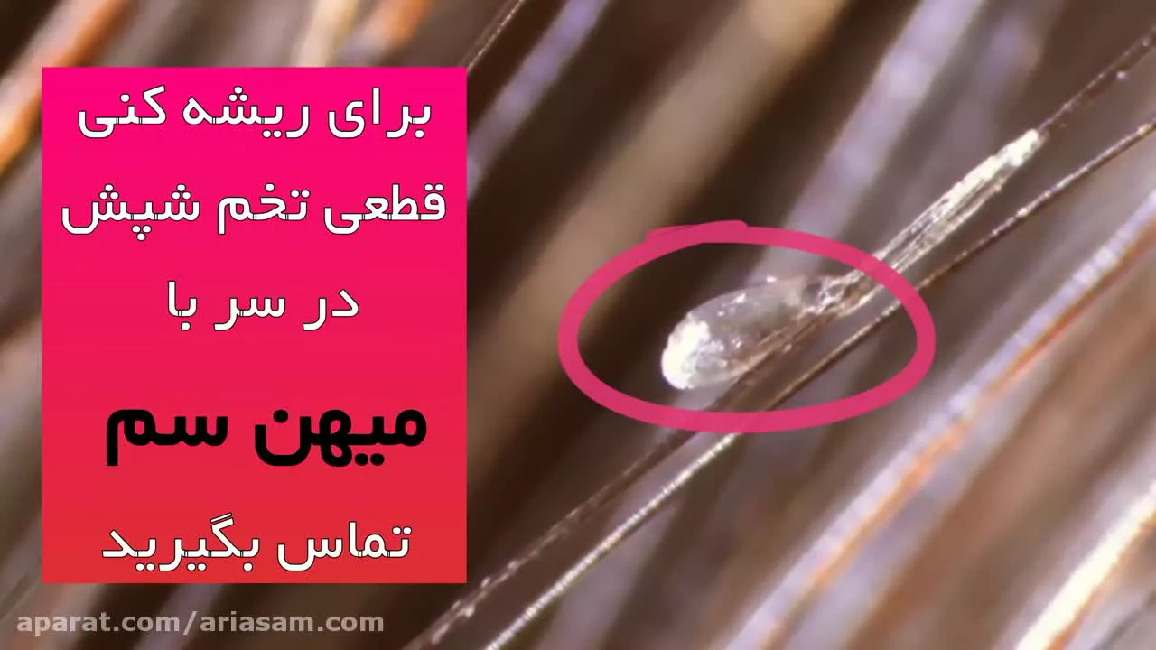 گالری عکس شپش گالری عکس شپش