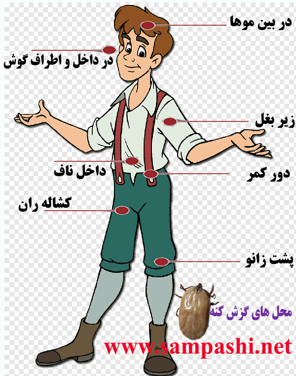 گزش کنه گزش کنه
