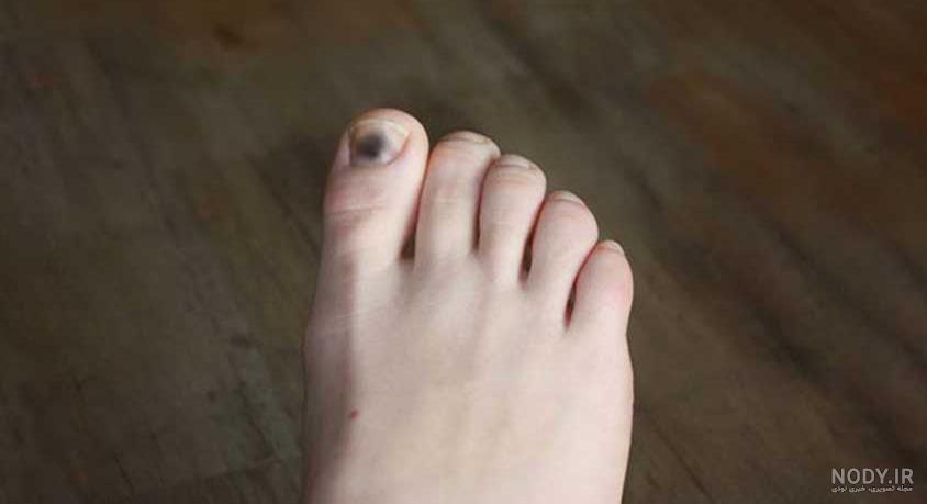 عکس دست رونالدو