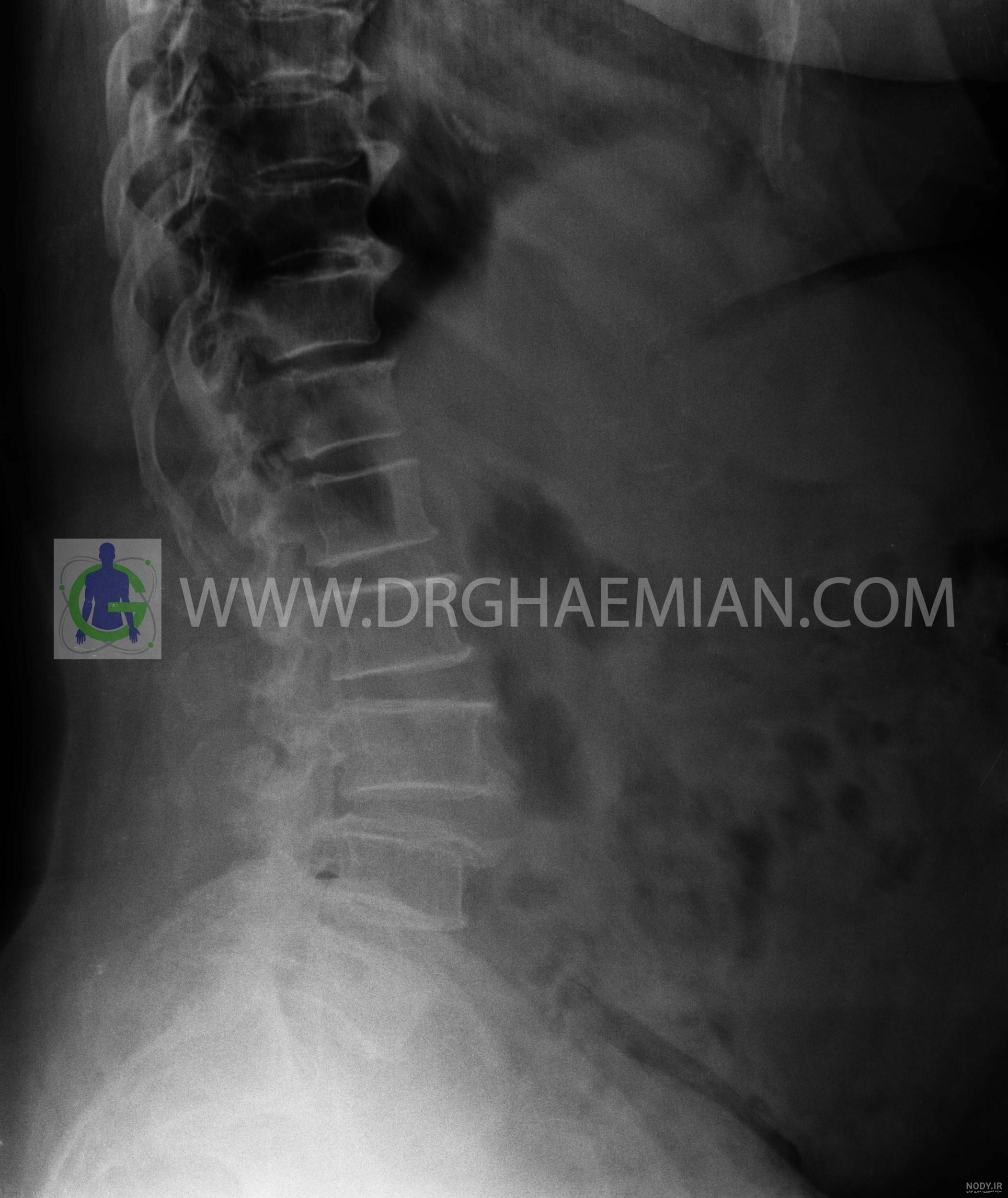 عکس ساده بنفش کمرنگ